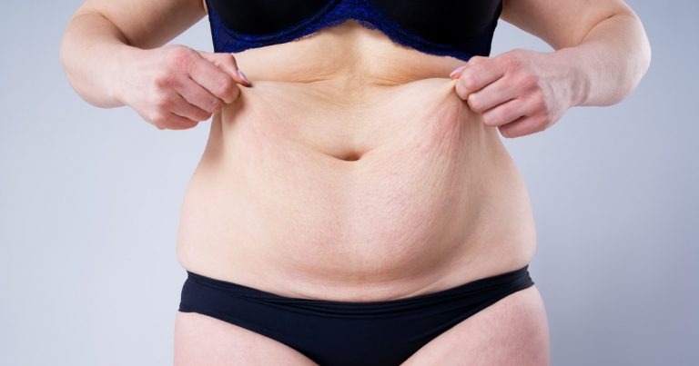 Considering a Tummy Tuck in Dubai Is It the Right Step for You